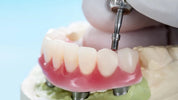 The Three Questions Everyone Asks about Dental Implants